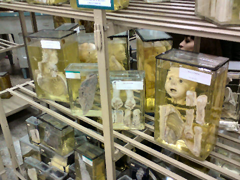 Pathology Museum